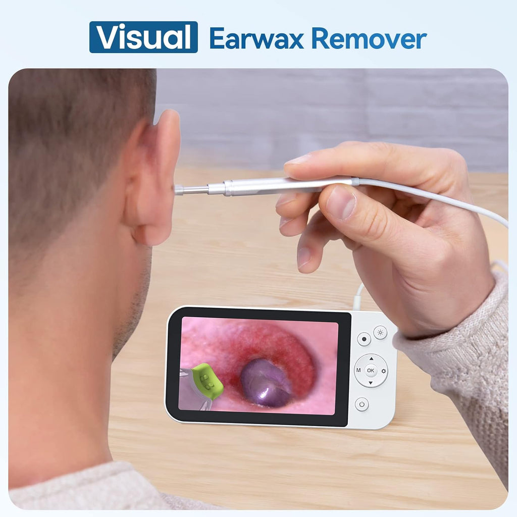 Digital Otoscope with 5 Inch IPS Screen A679389