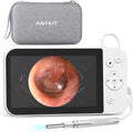 Digital Otoscope with 5 Inch IPS Screen A679389