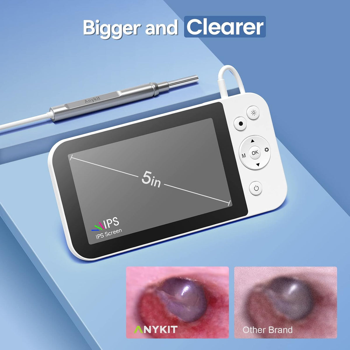 Digital Otoscope with 5 Inch IPS Screen A679389